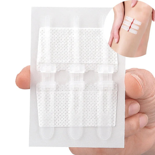 Self-Adhesive Personal Health Care Suture